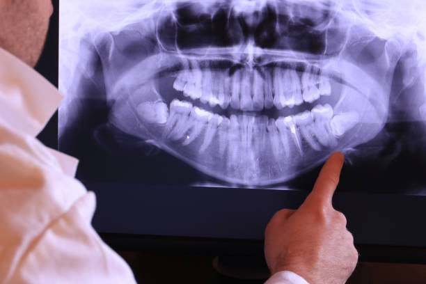 Best Emergency Dental Surgery in Winnebago, IL