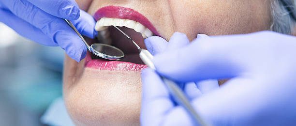 Best Emergency Wisdom Teeth Removal in Winnebago, IL