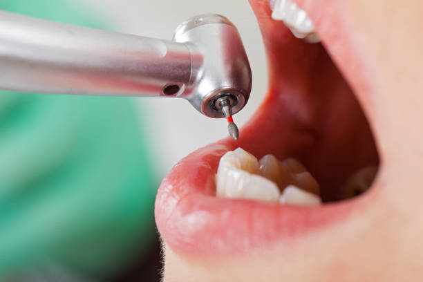 Best Emergency Broken Tooth Repair in Winnebago, IL